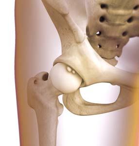 Hip Synovitis