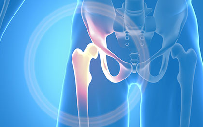 Treatment For Hip Bursitis and Causes Melbourne